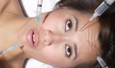 Пластика лица филлерами – что нужно знать, если вы решились