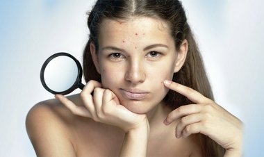 Уход за подростковой кожей: как избавиться от прыщей